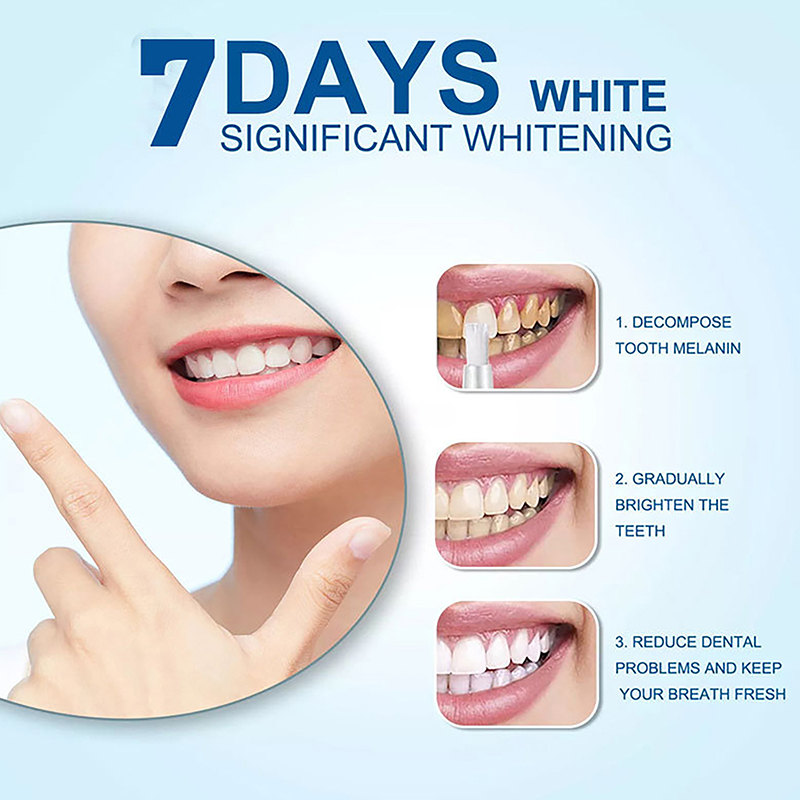 Teeth Whitening Pen Profession - Teeth Whitening Bleaching Kit 评论和价格