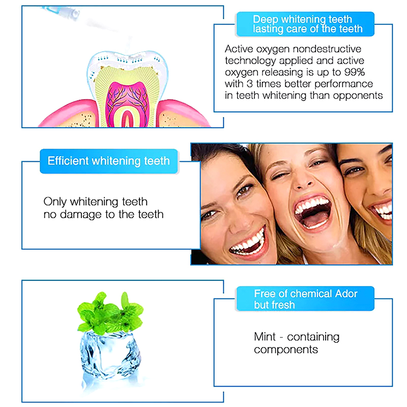 Teeth Whitening Pen Profession - Teeth Whitening Bleaching Kit 评论和价格