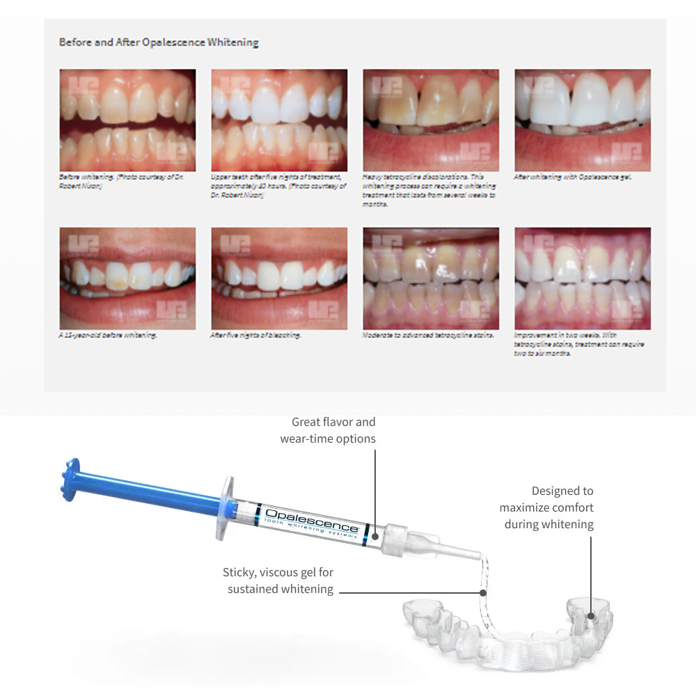 Opalescence Whitening 20% PF 2 - Teeth Whitening Home Kit 评论和价格