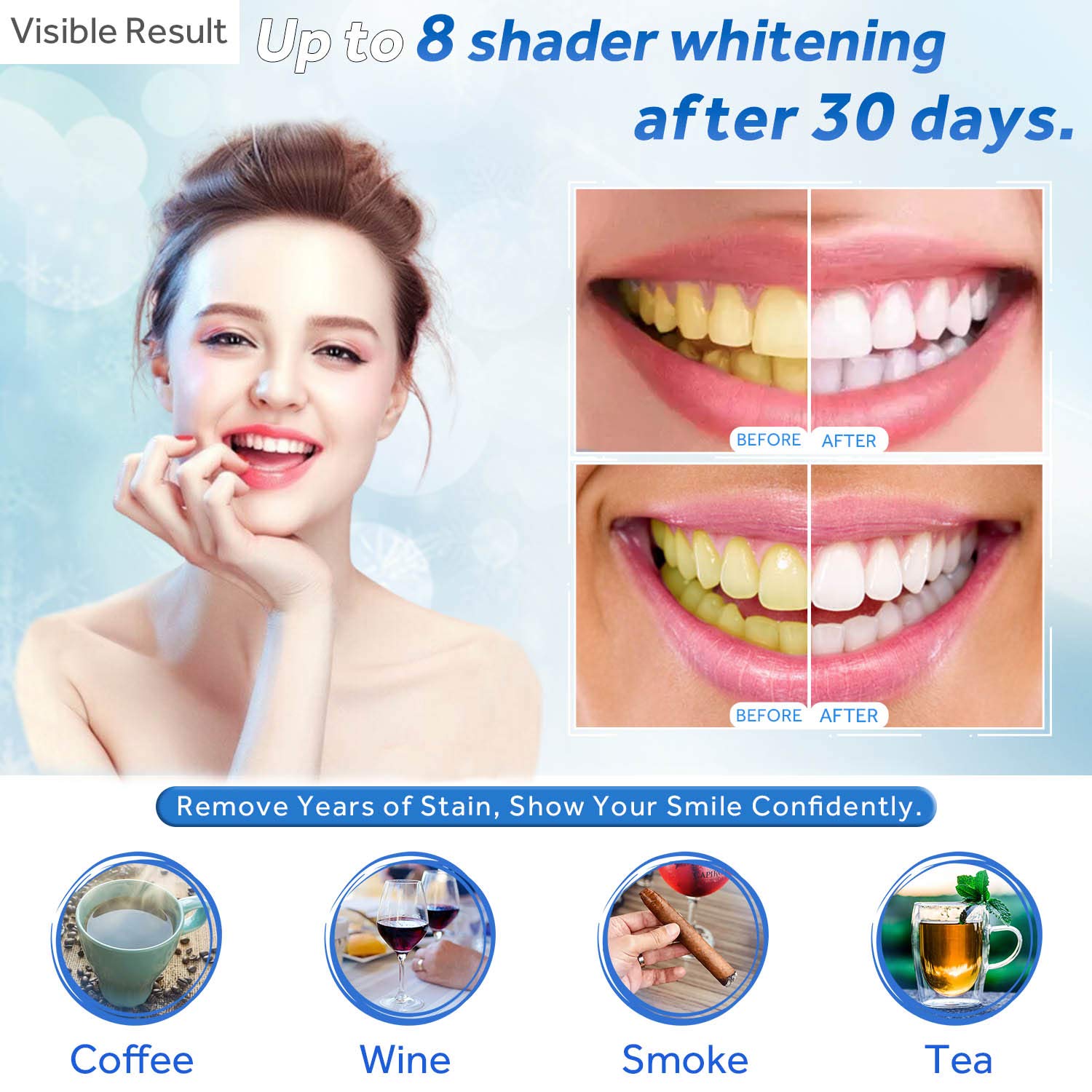 Teeth Whitening Gel Refill Syr - Teeth Whitening Procedure 评论和价格