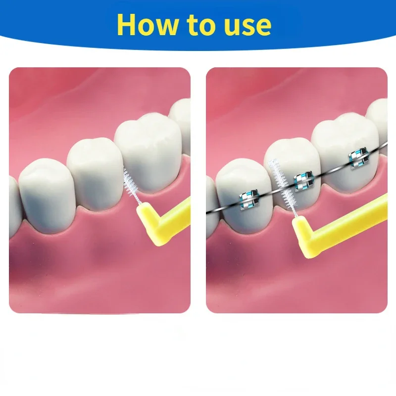 10Pcs L Shape Push-Pull Interd - Teeth Whitening Toothbrush 评论和价格