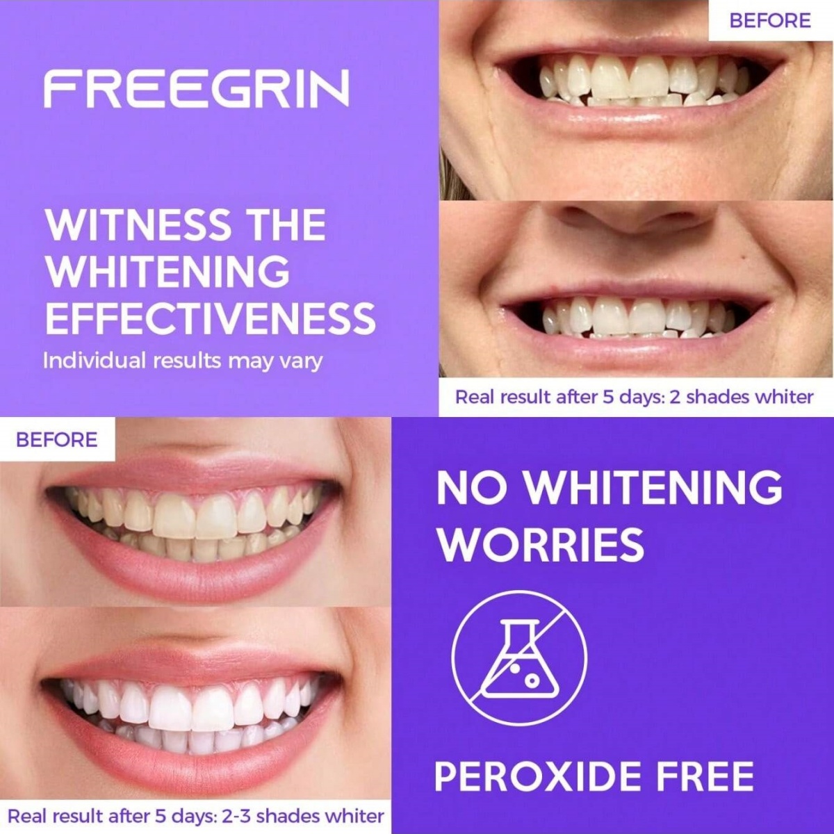 Deluxe Whitening Teeth Sticker - Teeth Whitening Groupon 评论和价格