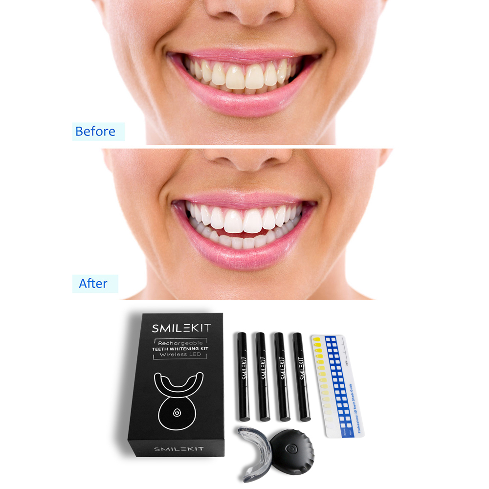 New Electric Teeth Whitening L - Teeth Whitening Home Kit 评论和价格